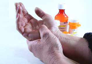 Methode fir Arthritis an Arthrose ze behandelen