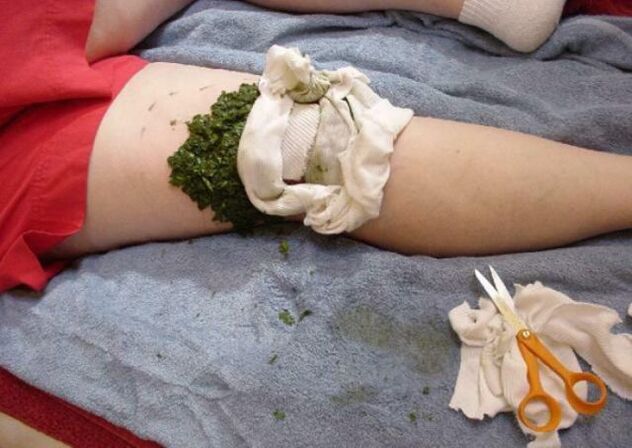 Kompresse fir Arthrosis vum Kniegelenk