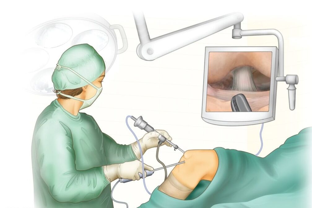 Kniechirurgie