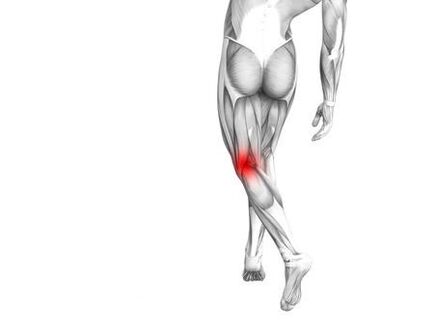 Osteoarthritis vum Kniegelenk