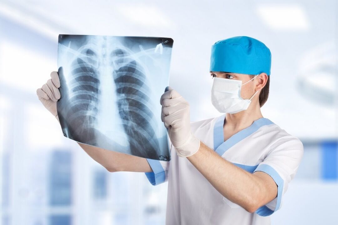 Röntgen vun der Këscht mat Osteochondrose