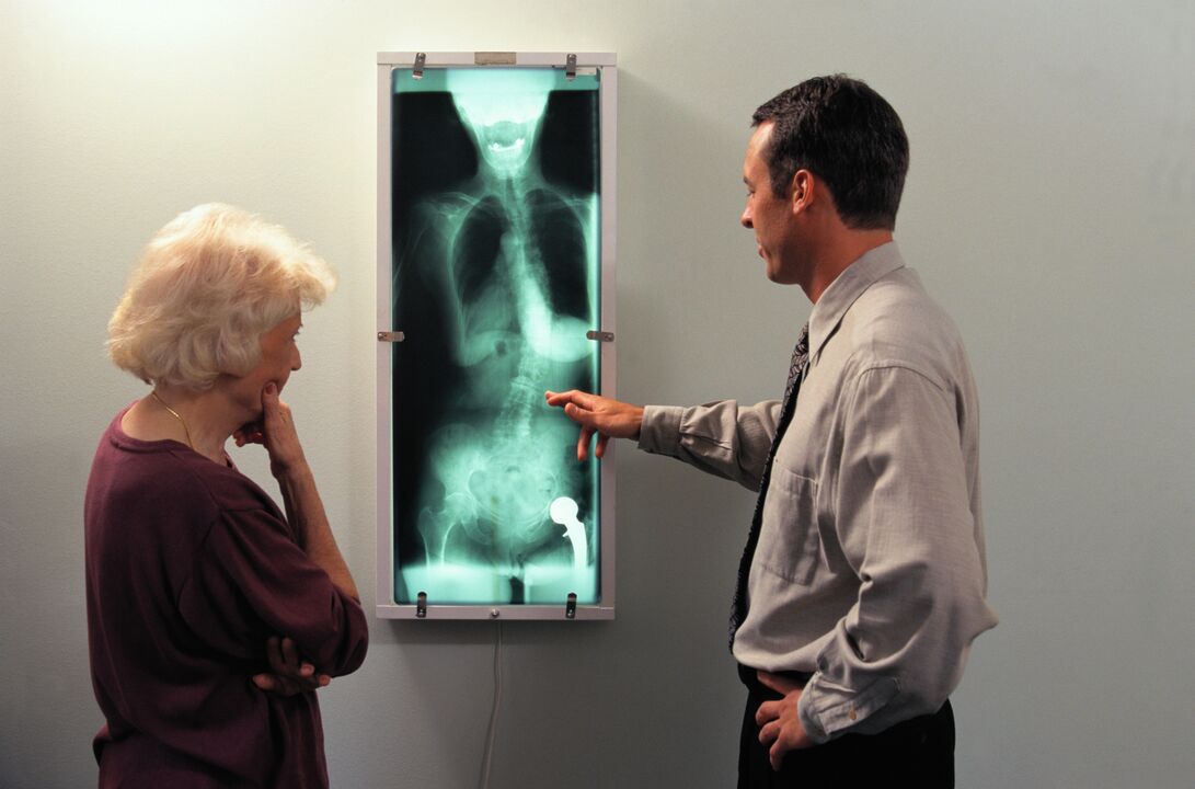 Röntgendiagnostik fir Péng am Hip Gelenk