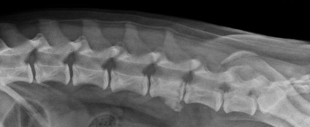 Manifestatiounen vun Osteochondrose vun der thoracic Wirbelsäule op engem Röntgenbild
